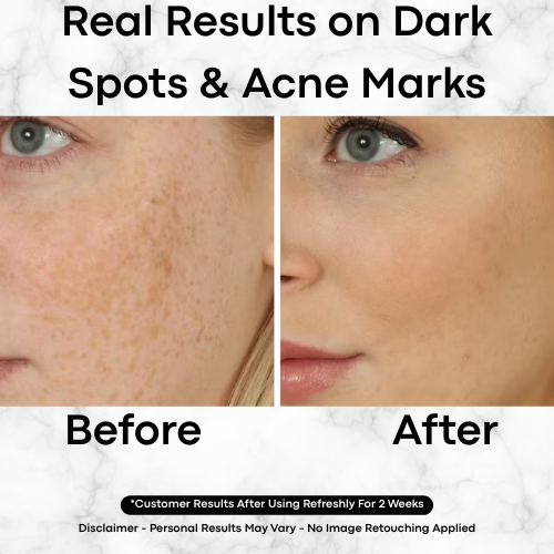 Korean Toner Pads for Dark Spots, Texture & Brighter Skin