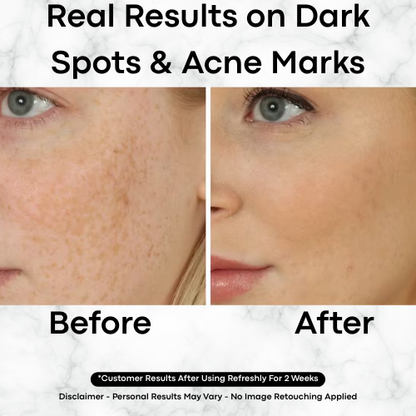 Korean Toner Pads for Dark Spots, Texture & Brighter Skin