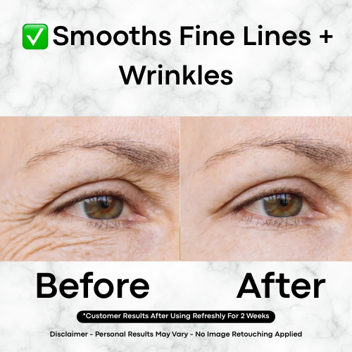 Refreshly™ Glass Skin Serum