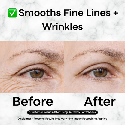 Refreshly™ Glass Skin Serum