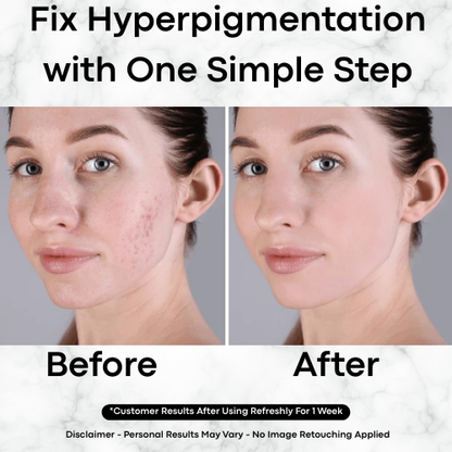 Korean Toner Pads for Dark Spots, Texture & Brighter Skin