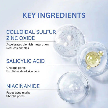 24H Acne Drying Lotion – Overnight Relief for Painful, Inflamed Pimples