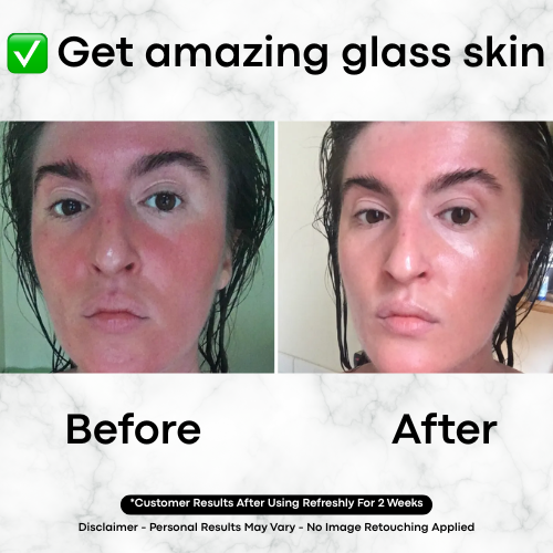 Refreshly™ Glass Skin Serum